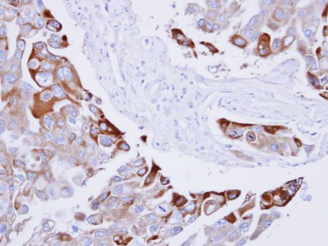 RAC1 Antibody - IHC of paraffin-embedded H441 xenograft using RAC1 antibody at 1:100 dilution.