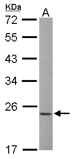 RAC1 Antibody - Sample (50 ug of whole cell lysate). A: mouse liver. 12% SDS PAGE. RAC1 antibody diluted at 1:1000.
