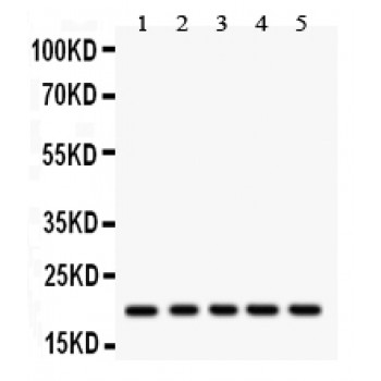 RAC1 Antibody - RAC1 antibody Western blot. All lanes: Anti RAC1 at 0.5 ug/ml. Lane 1: Rat Pancreas Tissue Lysate at 50 ug. Lane 2: Mouse Intestine Tissue Lysate at 50 ug. Lane 3: HELA Whole Cell Lysate at 40 ug. Lane 4: COLO320 Whole Cell Lysate at 40 ug. Lane 5: SGC Whole Cell Lysate at 40 ug. Predicted band size: 21 kD. Observed band size: 21 kD.