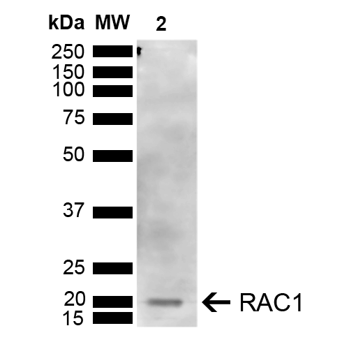 RAC1 Antibody - Western blot analysis of Human Embryonic kidney epithelial cell line (HEK293T) lysate showing detection of ~21 kDa RAC1 protein using Rabbit Anti-RAC1 Polyclonal Antibody. Lane 1: Molecular Weight Ladder (MW). Lane 2: HEK293T. Load: 10 µg. Block: 5% Skim Milk in 1X TBST. Primary Antibody: Rabbit Anti-RAC1 Polyclonal Antibody  at 1:1000 for 2 hours at RT. Secondary Antibody: Goat Anti-Rabbit IgG: HRP at 1:4000 for 1 hour at RT. Color Development: ECL solution for 5 min at RT. Predicted/Observed Size: ~21 kDa.