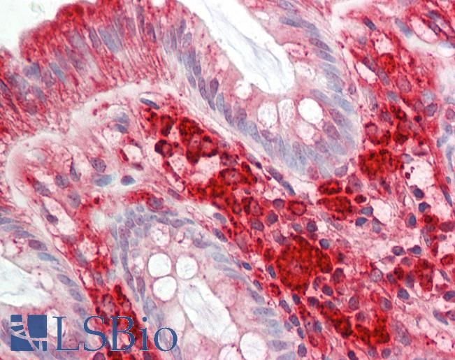 RAC1 Antibody - Human Colon: Formalin-Fixed, Paraffin-Embedded (FFPE).  This image was taken for the unconjugated form of this product. Other forms have not been tested.