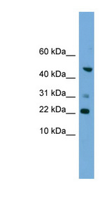 RAC1 Antibody - RAC1 antibody western blot of HepG2 cell lysate.  This image was taken for the unconjugated form of this product. Other forms have not been tested.