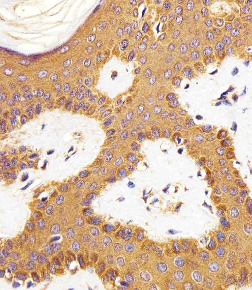 RAC1 Antibody - Immunohistochemical of paraffin-embedded H.skin section using RAC1. Antibody was diluted at 1:25 dilution. A peroxidase-conjugated goat anti-rabbit IgG at 1:400 dilution was used as the secondary antibody, followed by DAB staining.