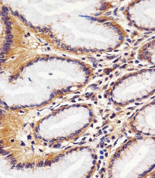 RAC1 Antibody - Immunohistochemical of paraffin-embedded H.stomach section using RAC1. Antibody was diluted at 1:25 dilution. A peroxidase-conjugated goat anti-rabbit IgG at 1:400 dilution was used as the secondary antibody, followed by DAB staining.