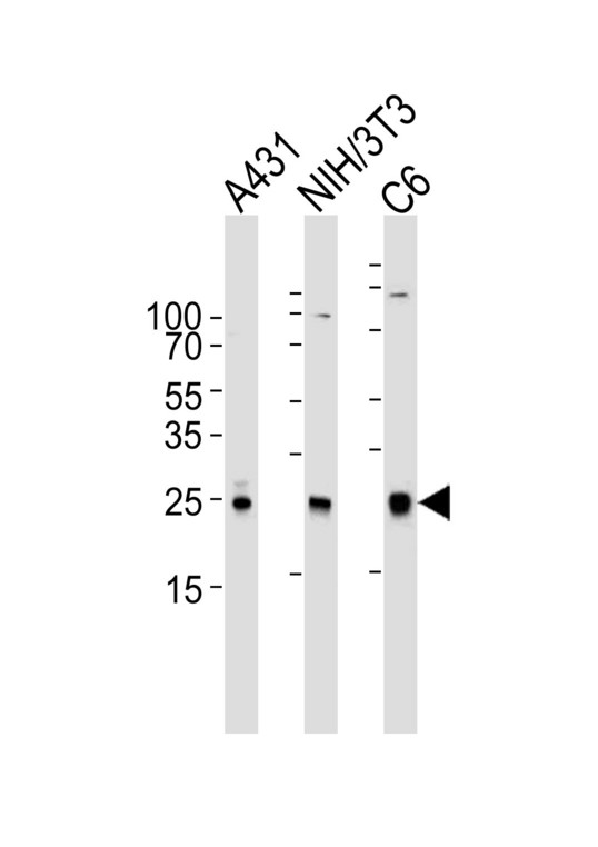 RAC1 Antibody - Western blot of lysates from A431, mouse NIH/3T3, rat C6 cell line (from left to right) with RAC1 Antibody. Antibody was diluted at 1:1000 at each lane. A goat anti-mouse IgG H&L (HRP) at 1:3000 dilution was used as the secondary antibody. Lysates at 35 ug per lane.