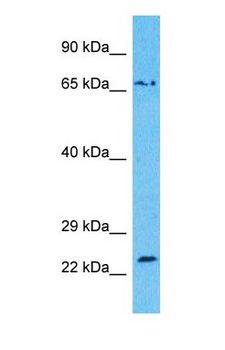 RAC1 Antibody - Western blot of RAC1 Antibody with human U937 Whole Cell lysate.  This image was taken for the unconjugated form of this product. Other forms have not been tested.