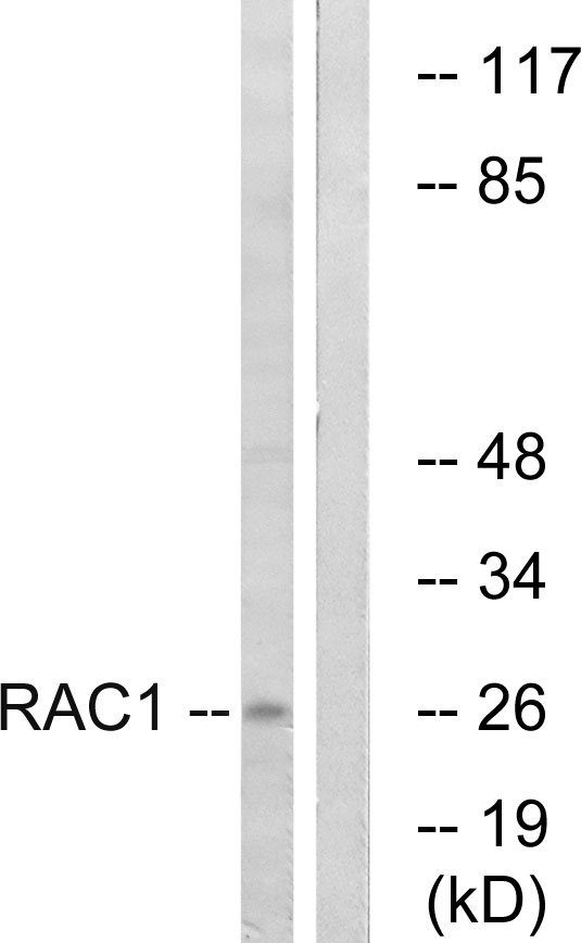 RAC1 Antibody - Western blot analysis of lysates from NIH/3T3 cells, treated with EGF 200ng/ml 30', using Rac1/CDC42 Antibody. The lane on the right is blocked with the synthesized peptide.