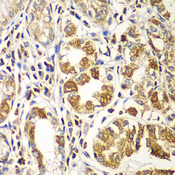 RAC1 Antibody - Immunohistochemistry of paraffin-embedded human gastric tissue.