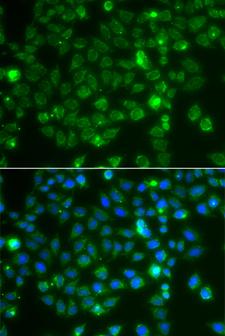 RAC1 Antibody - Immunofluorescence analysis of A549 cells.
