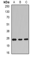 RAC1 Antibody - Western blot analysis of Rac 1 expression in BT474 (A); mouse liver (B); rat brain (C) whole cell lysates.