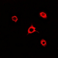 RAC1 Antibody - Immunofluorescent analysis of Rac 1 staining in A549 cells. Formalin-fixed cells were permeabilized with 0.1% Triton X-100 in TBS for 5-10 minutes and blocked with 3% BSA-PBS for 30 minutes at room temperature. Cells were probed with the primary antibody in 3% BSA-PBS and incubated overnight at 4 deg C in a humidified chamber. Cells were washed with PBST and incubated with a DyLight 594-conjugated secondary antibody (red) in PBS at room temperature in the dark.
