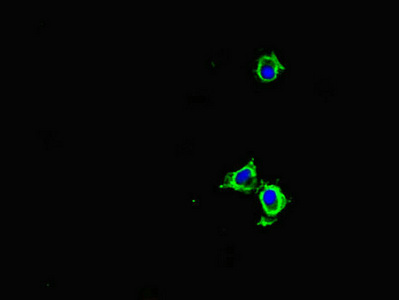 RAC1 Antibody - Immunofluorescent analysis of HeLa cells diluted at 1:100 and Alexa Fluor 488-congugated AffiniPure Goat Anti-Rabbit IgG(H+L)