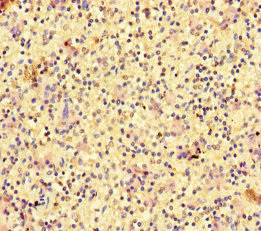 RAC1 Antibody - Immunohistochemistry of paraffin-embedded human spleen tissue at dilution of 1:100