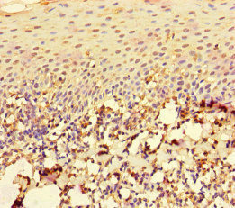 RAC1 Antibody - Immunohistochemistry of paraffin-embedded human tonsil tissue at dilution of 1:100