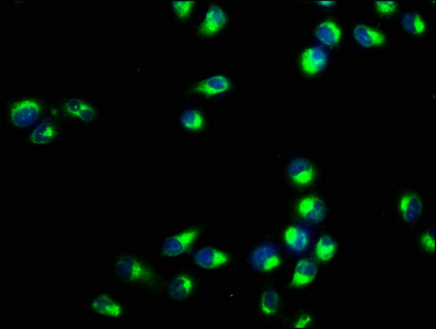 RAC1 Antibody - Immunofluorescence staining of Hela cells with RAC1 Antibody at 1:400, counter-stained with DAPI. The cells were fixed in 4% formaldehyde, permeabilized using 0.2% Triton X-100 and blocked in 10% normal Goat Serum. The cells were then incubated with the antibody overnight at 4°C. The secondary antibody was Alexa Fluor 488-congugated AffiniPure Goat Anti-Rabbit IgG(H+L).