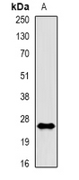 RAC1 Antibody - Western blot analysis of Rac 1 (pS71) expression in A431 EGF-treated (A) whole cell lysates.