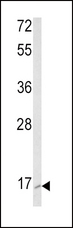 RAC2 Antibody - Western blot of RAC2 Antibody in K562 cell line lysates (35 ug/lane). RAC2 (arrow) was detected using the purified antibody.