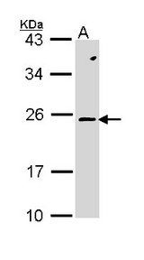 RAC2 Antibody - Sample (30 ug of whole cell lysate). A: Molt-4. 12% SDS PAGE. RAC2 antibody diluted at 1:1000. 