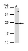 RAC2 Antibody - Sample (30 ug of whole cell lysate). A: Molt-4. 12% SDS PAGE. RAC2 antibody diluted at 1:1000. 