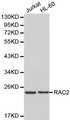 RAC2 Antibody - Western blot of RAC2 pAb in extracts from Jurkat and HL-60 cells.
