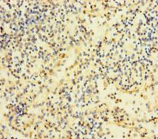 RAC2 Antibody - Immunohistochemistry of paraffin-embedded human spleen tissue using RAC2 Antibody at dilution of 1:100