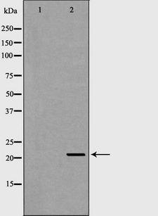 RAC2 Antibody - Western blot analysis of Jurkat cells using RAC2 antibody. The lane on the left is treated with the antigen-specific peptide.