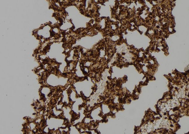 RAC2 Antibody - 1:100 staining mouse lung tissue by IHC-P. The sample was formaldehyde fixed and a heat mediated antigen retrieval step in citrate buffer was performed. The sample was then blocked and incubated with the antibody for 1.5 hours at 22°C. An HRP conjugated goat anti-rabbit antibody was used as the secondary.