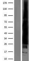 RAC2 Protein - Western validation with an anti-DDK antibody * L: Control HEK293 lysate R: Over-expression lysate
