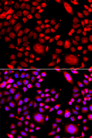 RAC3 Antibody - Immunofluorescence analysis of A549 cells.
