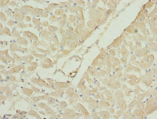 RAC3 Antibody - Immunohistochemistry of paraffin-embedded human heart tissue at dilution 1:100