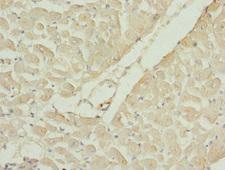 RAC3 Antibody - Immunohistochemistry of paraffin-embedded human heart tissue at dilution 1:100