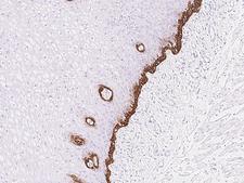 RAC3 Antibody - Immunochemical staining of human RAC3 in human esophagus with rabbit polyclonal antibody at 1:1000 dilution, formalin-fixed paraffin embedded sections.