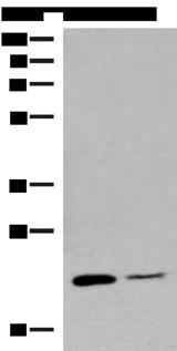 RAC3 Antibody - Western blot analysis of Human empty ileal tissue and Human ileum tissue lysates  using RAC3 Polyclonal Antibody at dilution of 1:400