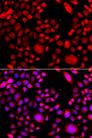RAC3 Antibody - Immunofluorescence analysis of A549 cells using RAC3 Polyclonal Antibody.