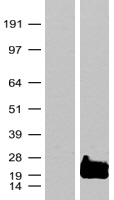 RAC3 Protein - Western validation with an anti-DDK antibody * L: Control HEK293 lysate R: Over-expression lysate