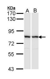 RACGAP1 / MGCRACGAP Antibody - Sample (30 ug of whole cell lysate). A: A431 , B: Raji. 7.5% SDS PAGE. RACGAP1 / MGCRACGAP antibody diluted at 1:1000.