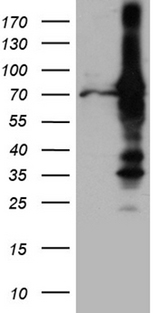 RACGAP1 / MGCRACGAP Antibody - HEK293T cells were transfected with the pCMV6-ENTRY control. (Left lane) or pCMV6-ENTRY RACGAP1. (Right lane) cDNA for 48 hrs and lysed. Equivalent amounts of cell lysates. (5 ug per lane) were separated by SDS-PAGE and immunoblotted with anti-RACGAP1. (1:2000)