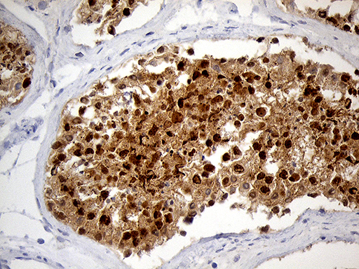 RACGAP1 / MGCRACGAP Antibody - Immunohistochemical staining of paraffin-embedded Human testicle tissue within the normal limits using anti-RACGAP1 mouse monoclonal antibody. (Heat-induced epitope retrieval by 1mM EDTA in 10mM Tris buffer. (pH8.5) at 120°C for 3 min. (1:2000)