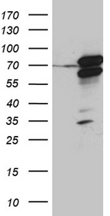 RACGAP1 / MGCRACGAP Antibody - HEK293T cells were transfected with the pCMV6-ENTRY control. (Left lane) or pCMV6-ENTRY RACGAP1. (Right lane) cDNA for 48 hrs and lysed. Equivalent amounts of cell lysates. (5 ug per lane) were separated by SDS-PAGE and immunoblotted with anti-RACGAP1. (1:2000)