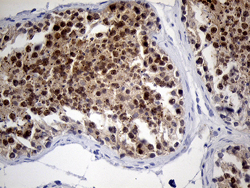 RACGAP1 / MGCRACGAP Antibody - Immunohistochemical staining of paraffin-embedded Human testicle tissue within the normal limits using anti-RACGAP1 mouse monoclonal antibody. (Heat-induced epitope retrieval by 1mM EDTA in 10mM Tris buffer. (pH8.5) at 120°C for 3 min. (1:150)