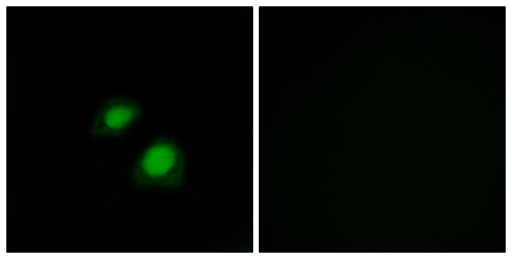RACGAP1 / MGCRACGAP Antibody - Immunofluorescence analysis of COS7 cells, using RGAP1 Antibody. The picture on the right is blocked with the synthesized peptide.