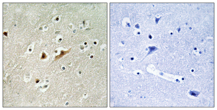 RACGAP1 / MGCRACGAP Antibody - Immunohistochemistry analysis of paraffin-embedded human brain tissue, using RGAP1 Antibody. The picture on the right is blocked with the synthesized peptide.