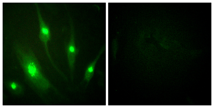RACGAP1 / MGCRACGAP Antibody - Immunofluorescence analysis of HeLa cells, using GTPase Activating Protein Antibody. The picture on the right is blocked with the synthesized peptide.