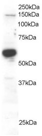 RACGAP1 / MGCRACGAP Antibody - Antibody staining (0.2 ug/ml) of Human Testis lysate (RIPA buffer, 30 ug total protein per lane). Primary incubated for 1 hour. Detected by Western blot of chemiluminescence.