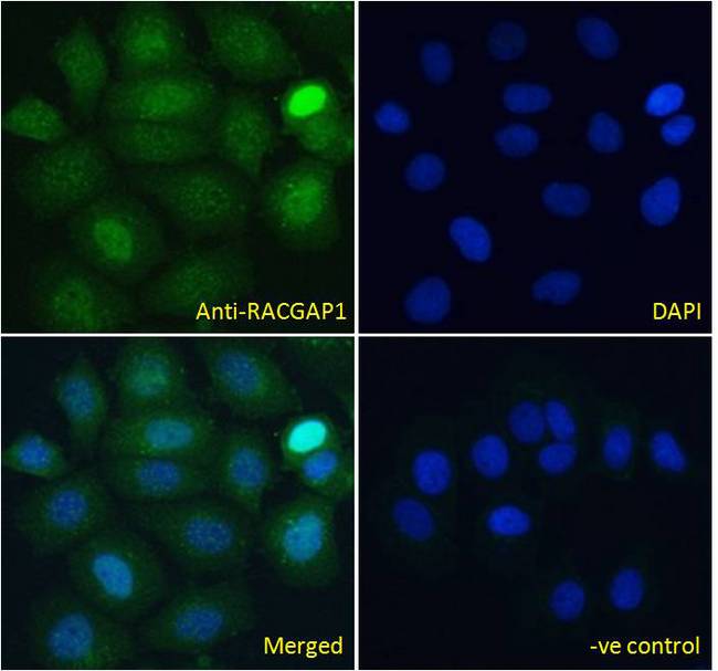 RACGAP1 / MGCRACGAP Antibody - RACGAP1 / MGCRACGAP antibody immunofluorescence analysis of paraformaldehyde fixed MCF7 cells, permeabilized with 0.15% Triton. Primary incubation 1hr (10ug/ml) followed by Alexa Fluor 488 secondary antibody (4ug/ml), showing nuclear staining. The nuclear stain is DAPI (blue). Negative control: Unimmunized goat IgG (10ug/ml) followed by Alexa Fluor 488 secondary antibody (2ug/ml).