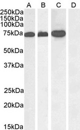 RACGAP1 / MGCRACGAP Antibody - RACGAP1 / MGCRACGAP antibody (1µg/ml) staining of A431 nuclear (A), Jurkat (B), Jurkat nuclear (C) and negative control Human Pancreas (D) lysate. (35µg protein in RIPA buffer) Detected by chemiluminescence.