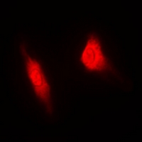 RACGAP1 / MGCRACGAP Antibody - Immunofluorescent analysis of MGCRACGAP staining in HeLa cells. Formalin-fixed cells were permeabilized with 0.1% Triton X-100 in TBS for 5-10 minutes and blocked with 3% BSA-PBS for 30 minutes at room temperature. Cells were probed with the primary antibody in 3% BSA-PBS and incubated overnight at 4 deg C in a humidified chamber. Cells were washed with PBST and incubated with a DyLight 594-conjugated secondary antibody (red) in PBS at room temperature in the dark. DAPI was used to stain the cell nuclei (blue).
