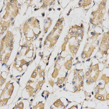 RACGAP1 / MGCRACGAP Antibody - Immunohistochemistry of paraffin-embedded human stomach using RACGAP1 antibody at dilution of 1:200 (x400 lens).