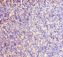 RACGAP1 / MGCRACGAP Antibody - Immunohistochemistry of paraffin-embedded human thymus tissue at dilution 1:100