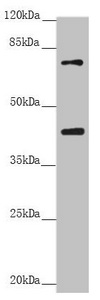 RACGAP1 / MGCRACGAP Antibody - Western blot All Lanes:RACGAP1 antibody at 2.68 ug/ml +Raji whole cell lysate Secondary Goat polyclonal to rabbit IgG at 1/10000 dilution Predicted band size: 71 kDa Observed band size: 71,40 kDa